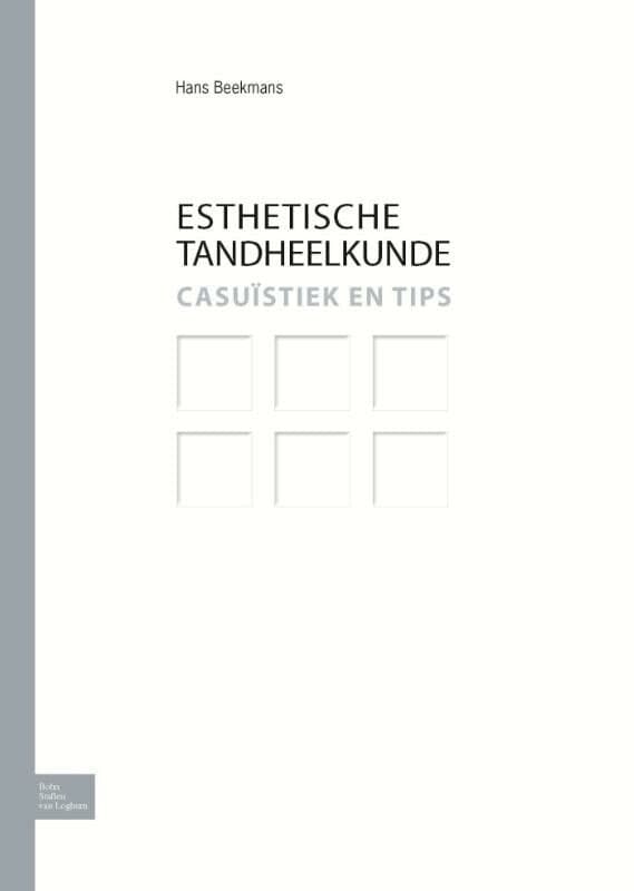 Esthetische Tandheelkunde (Hardback)