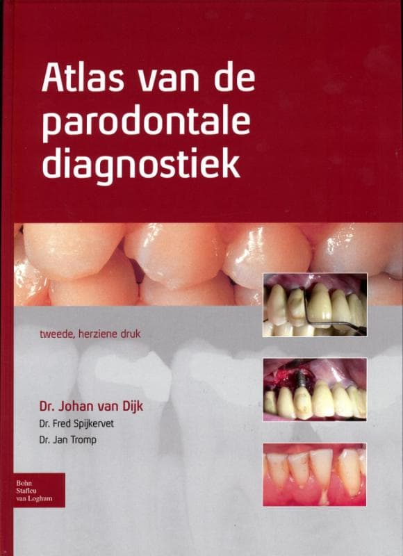 Atlas van de parodontale diagnostiek (Hardback)