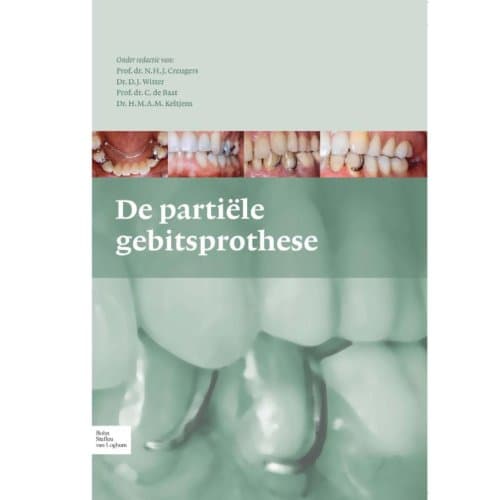 De Partiele Gebitsprothese - N.H.J. Creugers